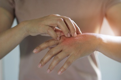 Person itching their hand.